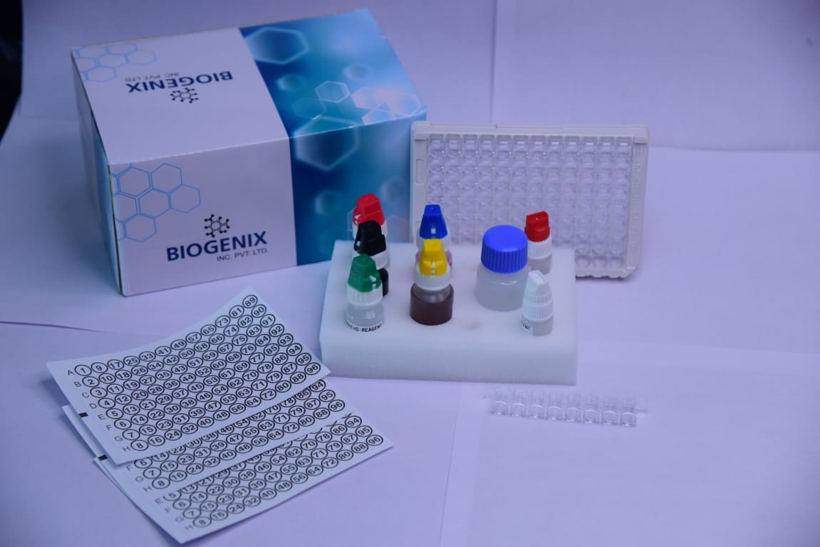 Rheumatoid Factor IgM (RF) ELISA Kit
